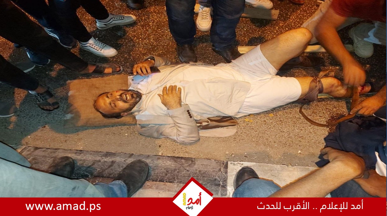 مسلحون يحاولون اغتيال رئيس بلدية الخليل - صورة وفيديو
