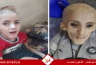 وفاة الطفل يزن الكفارنة تصدح بمأساة الجوع في غزة