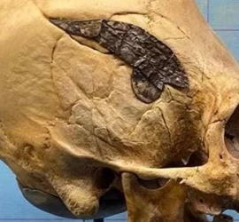 العثور على أول جمجمة خضعت لعملية جراحية منذ 2000 عام